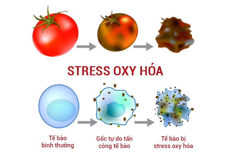 Stress oxy hóa 