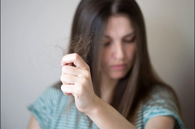 Hội chứng nghiện nhổ tóc