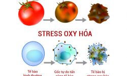 Stress oxy hóa
