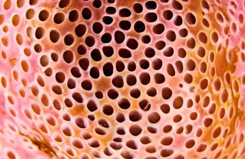 Hội chứng sợ lỗ (trypophobia)